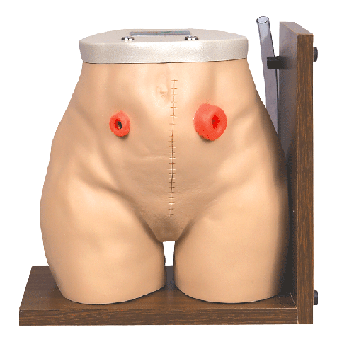 高級(jí)瘺管造口術(shù)護(hù)理模型 高級(jí)瘺管造口術(shù)護(hù)理模型