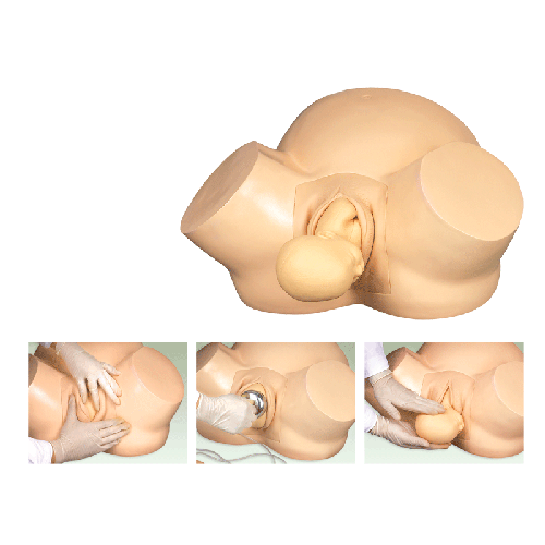 高級助產(chǎn)訓練模型 高級助產(chǎn)訓練模型