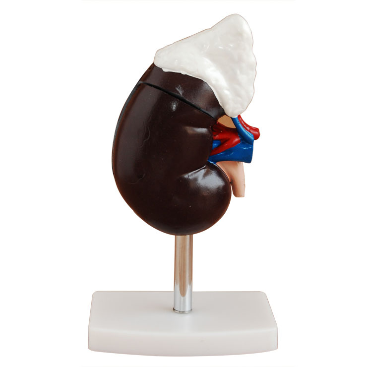 腎解剖附腎上腺模型 腎解剖附腎上腺模型