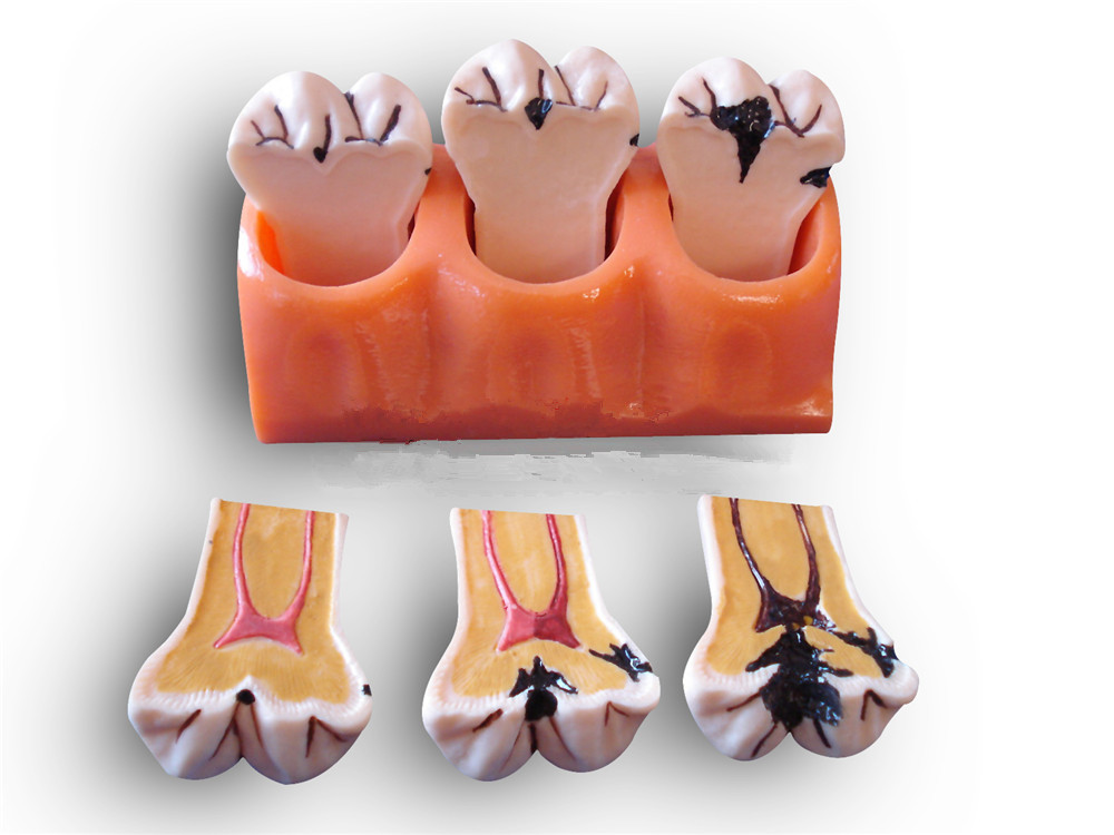 4���x�X�ֽ�ģ��