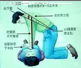 2015年國際新標(biāo)準(zhǔn)心肺復(fù)蘇術(shù)操作指南,流程 2015年國際新標(biāo)準(zhǔn)心肺復(fù)蘇術(shù)操作指南,流程